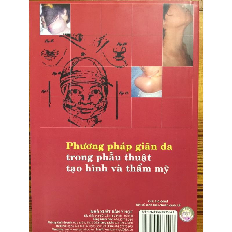 Phương Pháp Giãn Da Trong Phẫu Thuật Tạo Hình Và Thẩm Mỹ Phương Pháp Giãn Da Trong Phẫu Thuật Tạo Hình Và Thẩm Mỹ - Ảnh 2