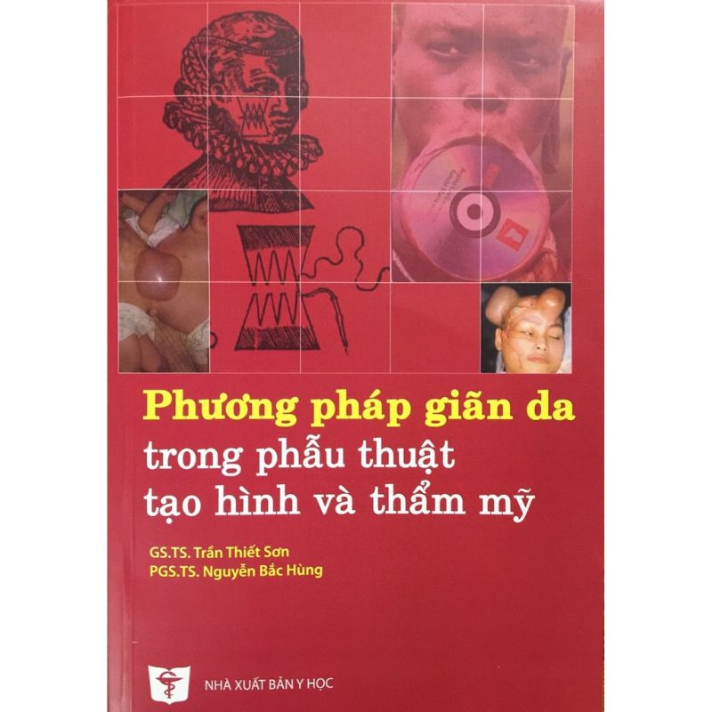 Phương Pháp Giãn Da Trong Phẫu Thuật Tạo Hình Và Thẩm Mỹ