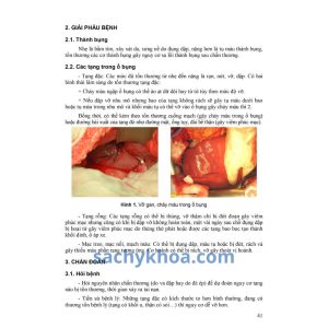 bai giang benh hoc ngoai khoa y4 h1