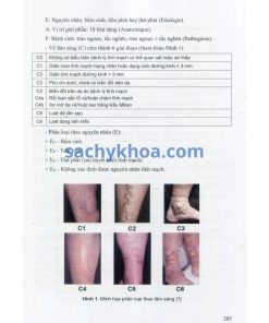 trieu chung hoc ngoai khoa y3 2024 h3